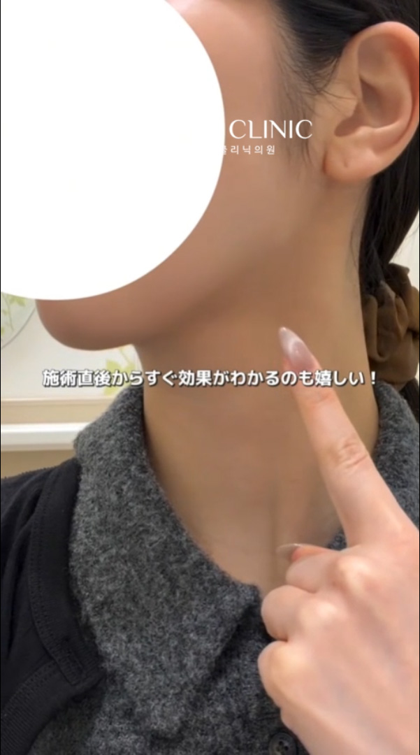 영상 썸네일 2