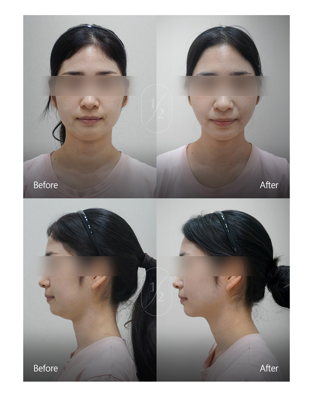 이미지 11